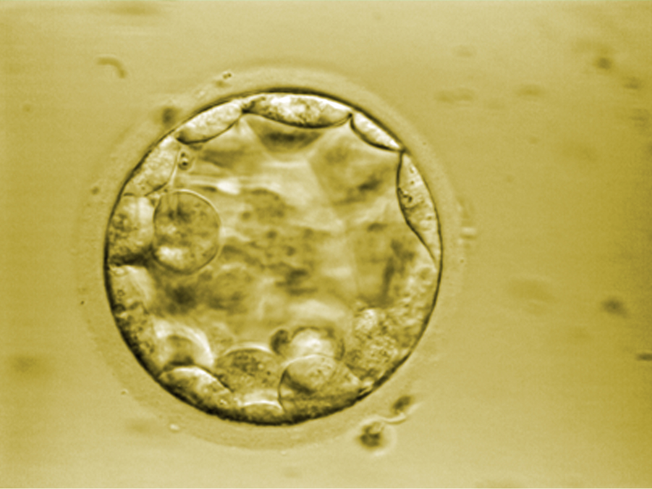 Embryon au stade Blastocyste (5 jours)